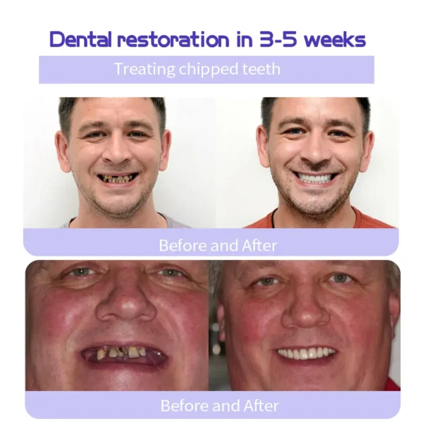 GarageLine™ Teeth Restoration Mineral Powder