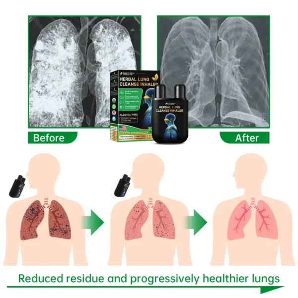 Furzero™ Health lung cleanse inhaler