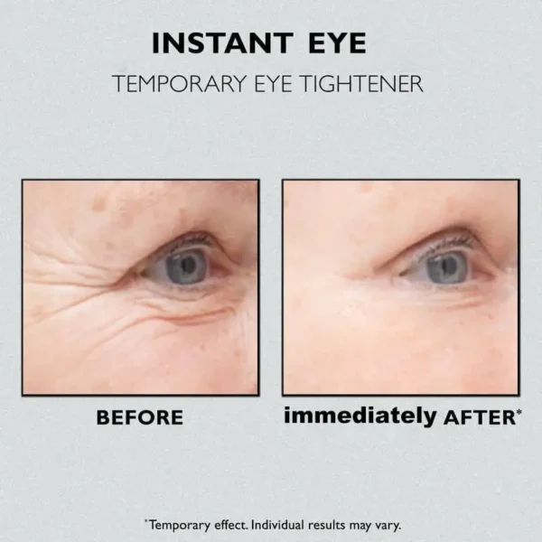 Lovilds™ Instant Eye Temporary Eye Tightener