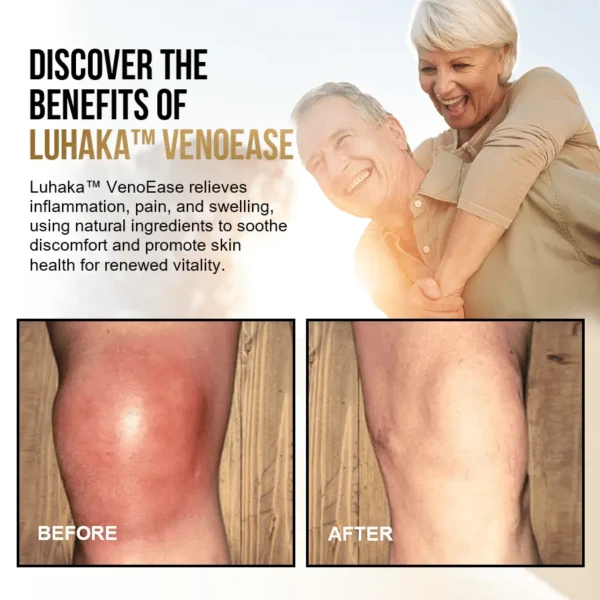 Luhaka™ VenoEase Swelling Reduction & Pain Relief Support