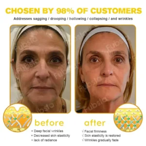 𝐅𝐮𝐛𝐬𝐭𝐚® 7-Day Botox Bee Venom Wrinkle Removal Cream