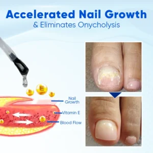 Fivfivgo™ NailNourish Growth & Repair Serum