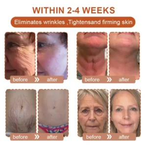 Flysmus™ BotoxBee Wrinkle Removal Cream